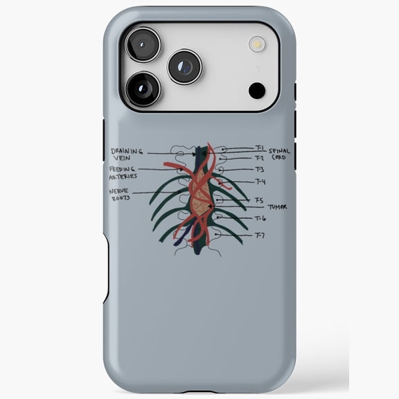 Greys Anatomy Tumor On The Wall Phone Cover for iPhone 11 12 13 14 15 16 17 Pro Max