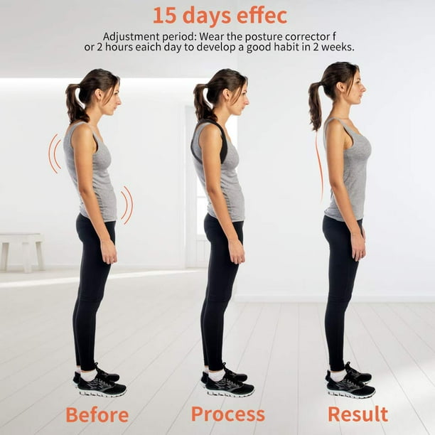 Tonus Elast Upper Back Brace Posture Corrector and Straightener