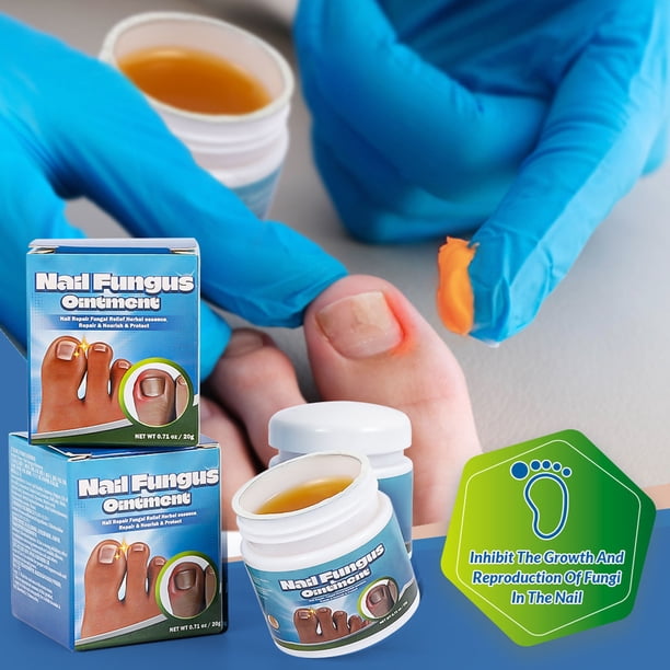 Crema Para Hongos En Las Uñas, Alivia La Picazón Y Promueve El Crecimiento De Las Uñas, , 0,7 Onzas, Crema Hidratante De Penetración Profunda Para Reparación De Hongos En
