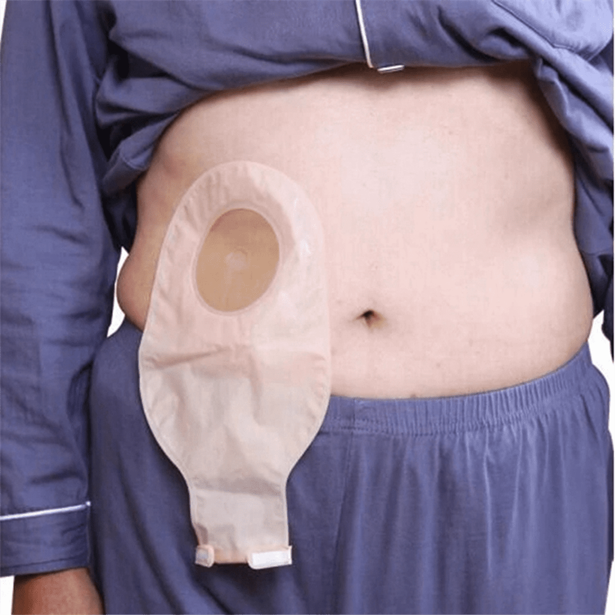 20Pcs Ostomy Bags Drainable Pouches for Colostomy Ileostomy Stoma Care 20-60mm Drain Valve