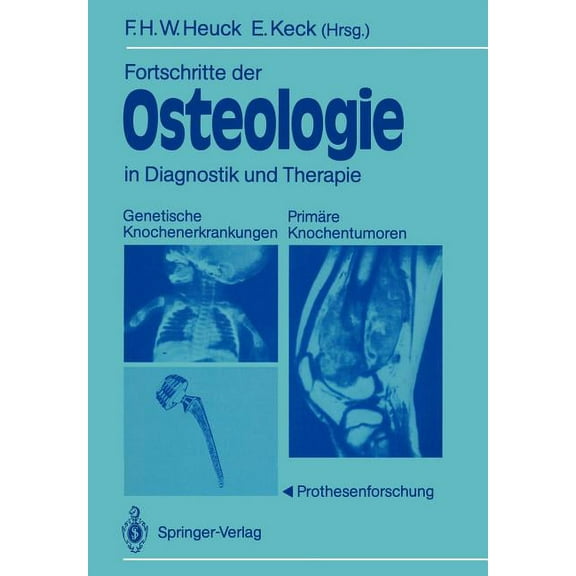 Fortschritte Der Osteologie in Diagnostik Und Therapie: Genetische Knochenerkrankungen Primäre Knochentumoren - Prothese, (Paperback)