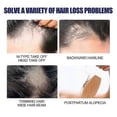thumbnail image 3 of Hair Growth Foam Spray Anti Hair Loss Treatment Hair Regrowth for Men, 3 of 5