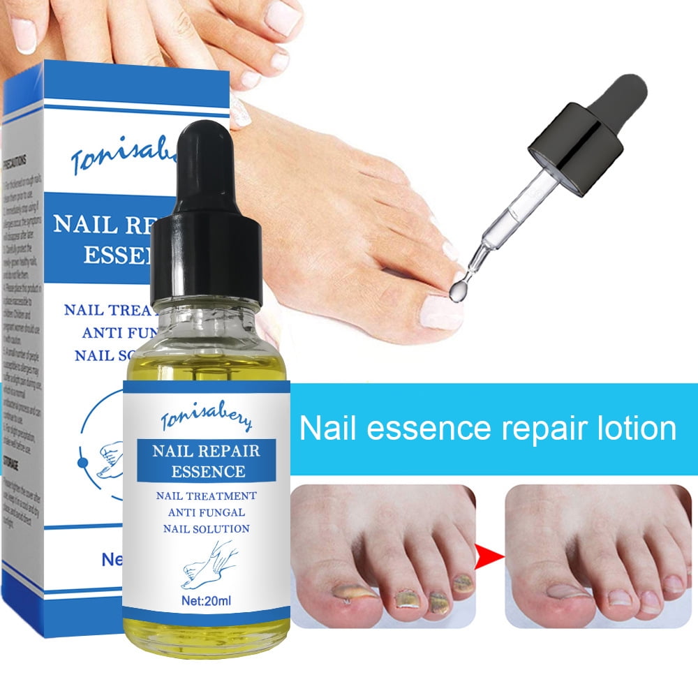 Nail Fungus Treatment Toenail Repair Essence Renew Damaged Discolored ...