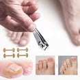 thumbnail image 4 of STAOEDU 40 Pack Professional Ingrown Toenail Correction Treatment Kit, 40 Pcs Ingrown Toenail Corrector Straightener Strips Recover Clips with Ingrown Toenail File, 4 of 5