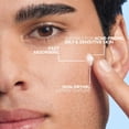 thumbnail image 3 of La Roche-Posay Effaclar BPO Multi-Target 5.5% Benzoyl Peroxide Acne Spot Treatment Cream, 0.7 fl oz, 3 of 10