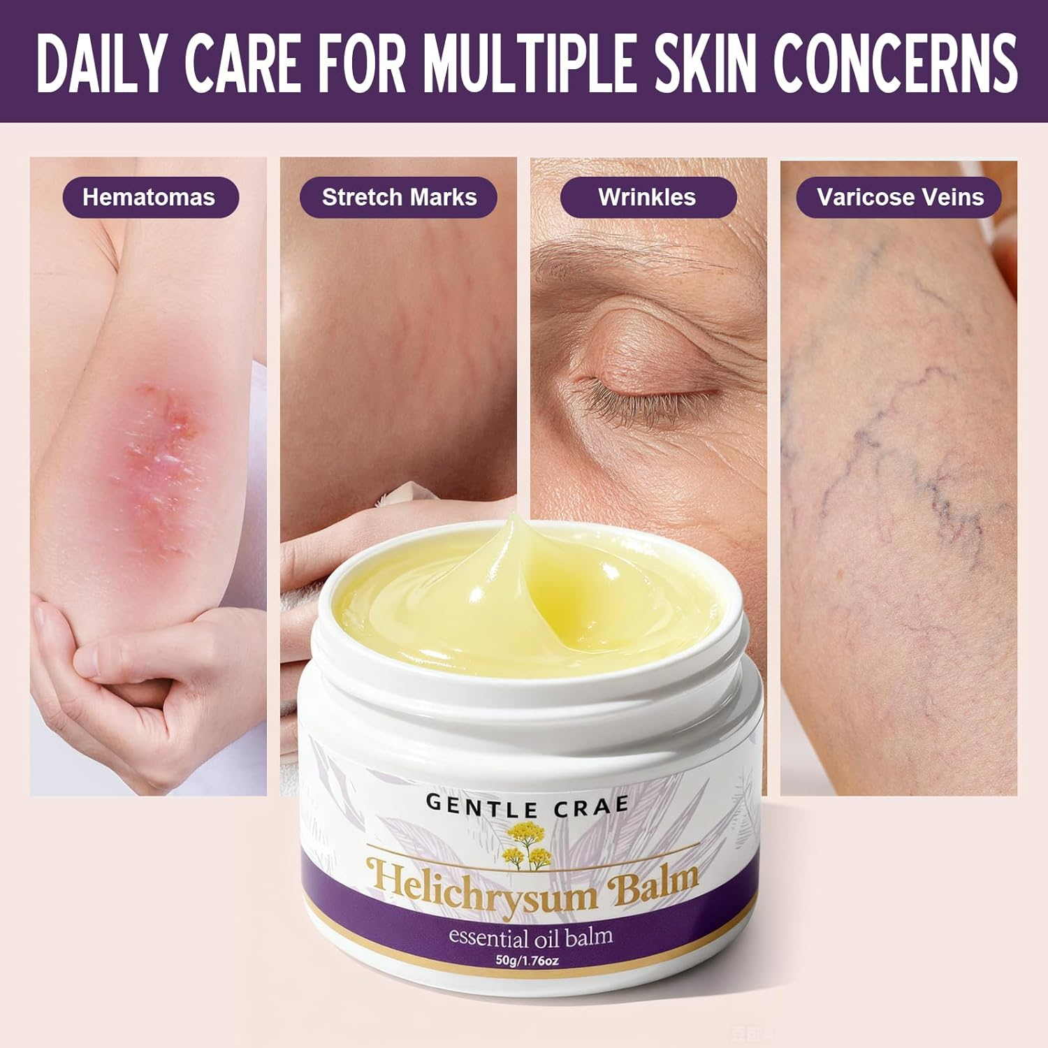 SKSOYT Helichrysum Balm with Essential Oil and Beeswax photo 5