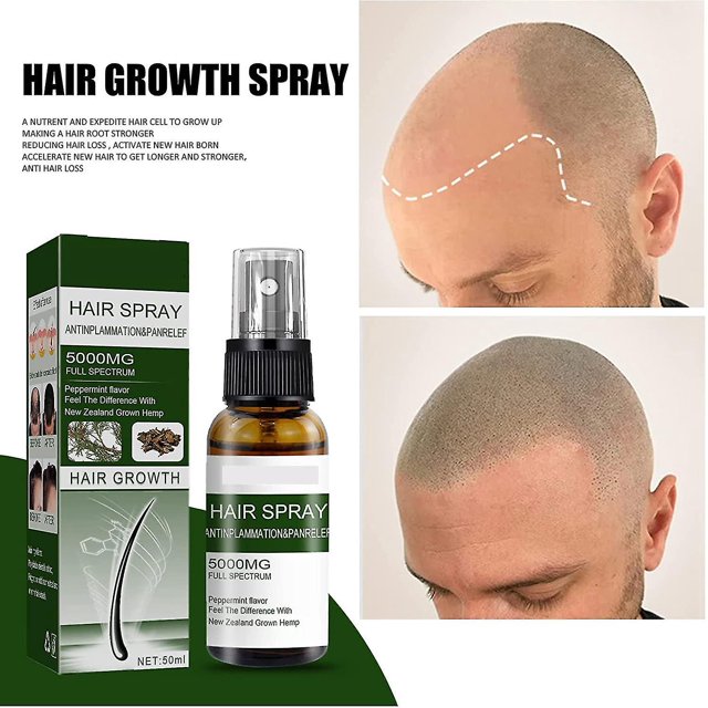 Spray de crecimiento del cabello de menta para el crecimiento del cabello, spray de esencia de crecimiento del cabello a base de hierbas naturales, spray de suero de ginseng de men