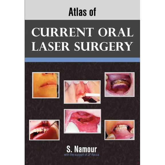 Atlas of Current Oral Laser Surgery, (Paperback)