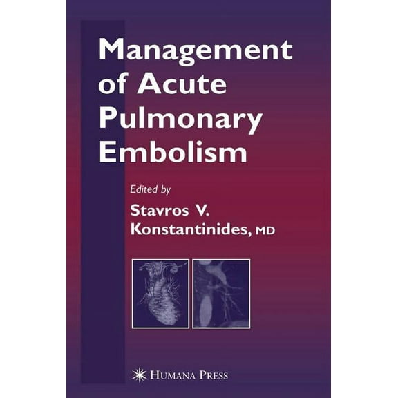 Contemporary Cardiology Management of Acute Pulmonary Embolism, (Hardcover)
