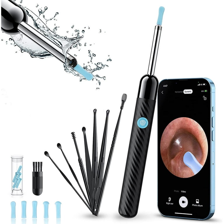 Kekoy Ear Wax Removal Kit, Ear Cleaner with Camera, 5 Megapixels 1080P Ear  Scope, Wireless Otoscope Ear Cleaning Kit with Lights and 6 Ear Scoops, Ear  Camera for iPhone, iPad, Android Phones 