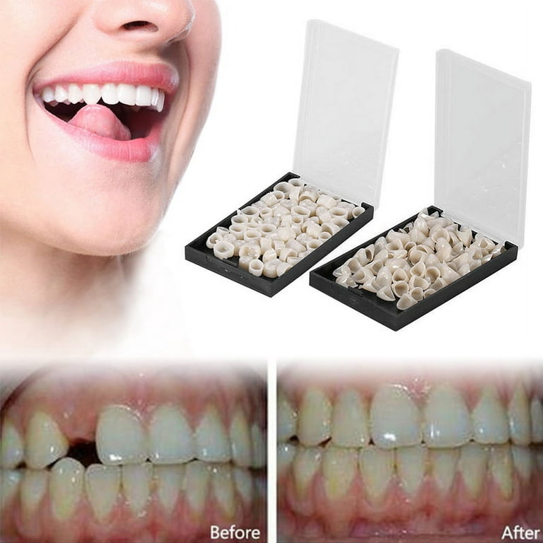 Temporary Tooth Repair Kit Thermal Beads for Filling Fix The Missing and Broken Tooth or Adhesive The Denture Fake Teeth