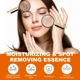 thumbnail image 5 of Suero eliminador de manchas oscuras, potente eliminación de puntos negros, Melasma, Chloasma, niacinamida, blanqueamiento, humedad, pecas, cuidado de la piel facial, 5 of 5