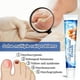 thumbnail image 2 of Crema Para Eliminar Hongos En Las Uñas, Crema Para Eliminar Hongos En Las Uñas, Onicomicosis, Crema Para Hongos En Las Uñas, Pomada Para El Cuidado De Las Uñas Con Hongos En ANGGREK Nail Fungus Removal Cream, 2 of 8