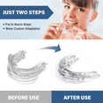 thumbnail image 5 of Anti Snoring Devices, custom mouthguard for sleeping, moldable mouthguard, snoring mouth guard for men and women as a snore stopper, 5 of 8