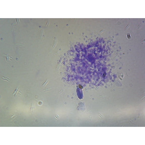 Staphylococcus Aureus; Smear; Gram-Positive by Go Science Crazy