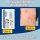 thumbnail image 5 of Ungüento antimicrobiano a base de hierbas, tratamiento de Psoriasis, Dermatitis, Eczema, antipicazón, alivia la erupciones, Urticaria, cuidado de descamación, 5 of 5