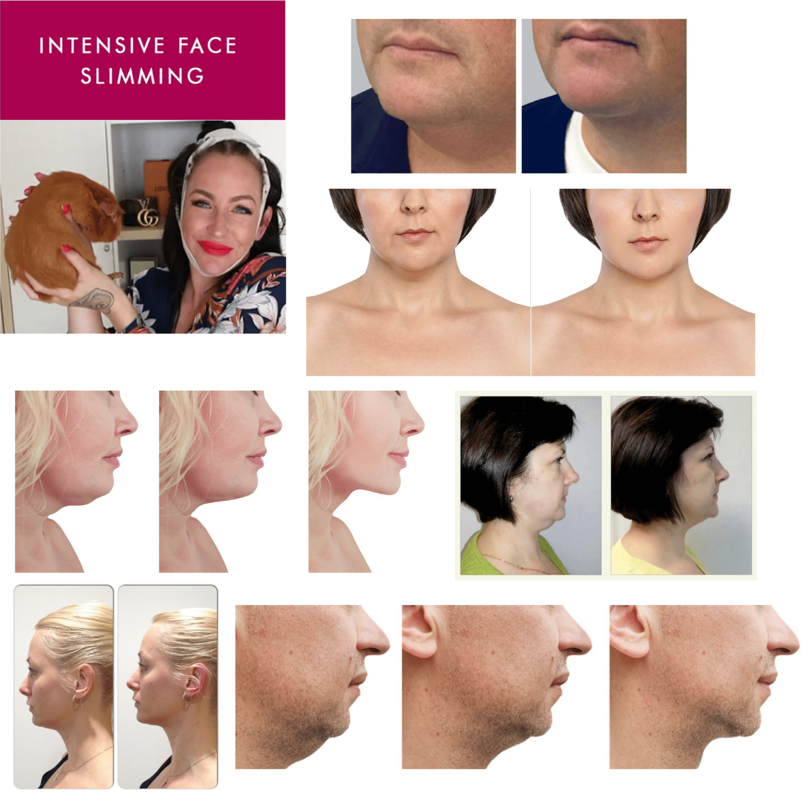 Anacis. Neck Tightening Firming Double Chin Reducer Face Lift Serum and Cream for All Skin Types