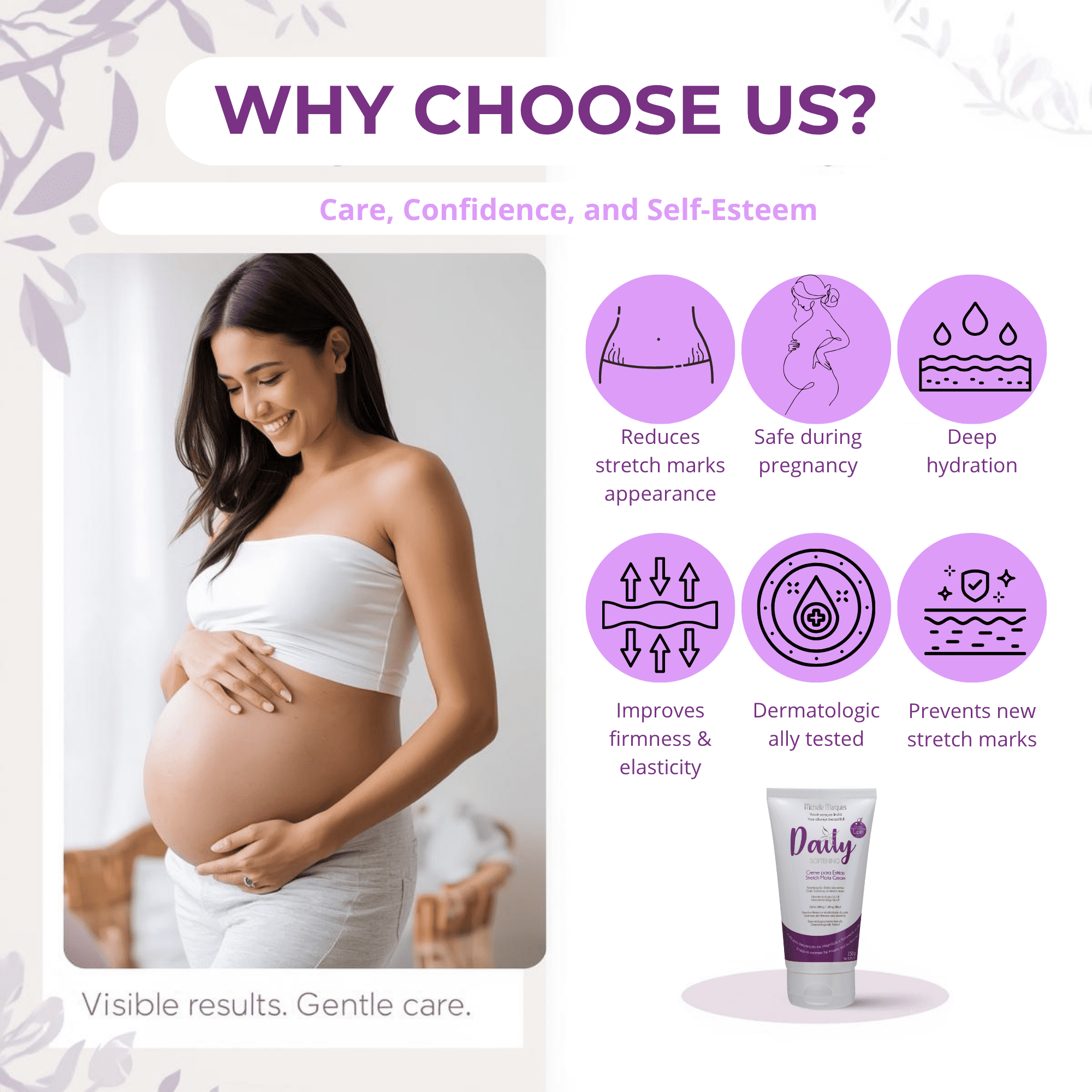 Michelle Marques Stretch Mark Cream – Pregnancy Safe, Hypoallergenic Formula with Almond Oil & Chamomile for Hydration and Elasticity (5.29 oz)