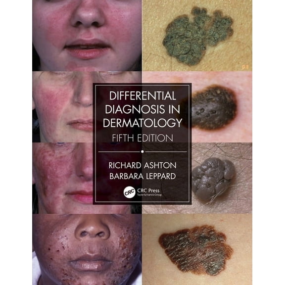 Differential Diagnosis in Dermatology, (Paperback)