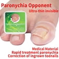 thumbnail image 2 of Corrector de uñas encarnadas Yuyangstore Silicona Tratamiento de paroniquia, 2 of 8