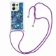 thumbnail image 3 of Funda FOXDOCK para Xiaomi Redmi Note 13 4G con Cuerda Ajustable, Brillo Líquido, Protección Antigolpes y Lente – Ideal para Regalo, 3 of 6