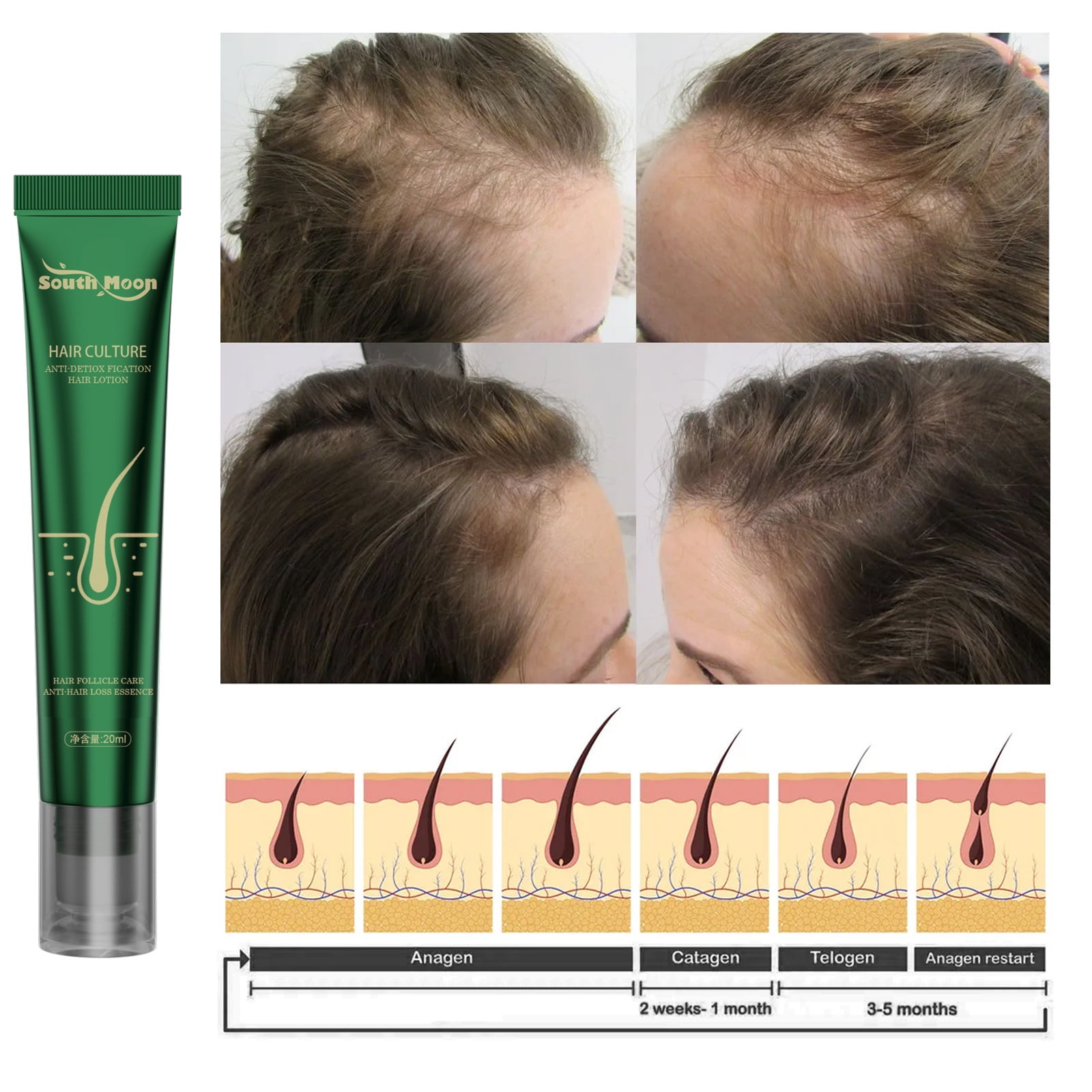 Buy Hair Growth Drops Rosemary Oil, Peptides & Minoxidil Hair Loss