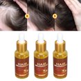 thumbnail image 1 of Castor Hair Growth Oil, Hair Regrowth Oil Thickening 3pcs 30ml  For Daily Use, 1 of 8