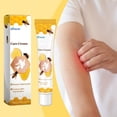 thumbnail image 4 of 20g VitiGO Bee Treatment Cream - 50% OFF, 4 of 8