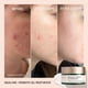 thumbnail image 3 of Hidratante Biossance Squalane + Gel equilibrante probiótico 50 ml, 3 of 8