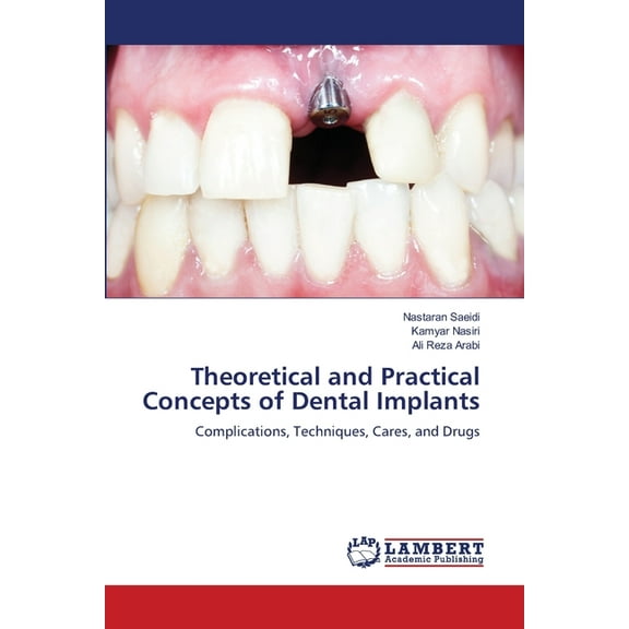 Theoretical and Practical Concepts of Dental Implants, (Paperback)