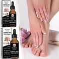 thumbnail image 2 of Nail Fungus-Treatments for Toenails Quick Absorption Nail Strengthening Liquid for Damaged-Nails, 2 of 5