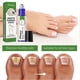 thumbnail image 2 of 1/2/3pcs Health Toenail Stick Roller Onychomycosis Care Nails Repair for Feet & Hands, Healthy Nail Solution for Women Men, 2 of 5