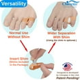 thumbnail image 2 of Chiroplax Tailor's Bunion Corrector Pads Bunionette Pain Relief Pinky Toe Straightener Separator Cushion Splint Protector Shield Spacer (4 Pads, Shims - Size Regular), 2 of 6