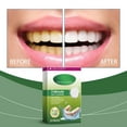 thumbnail image 4 of Pisexur Belleza Maquillaje Limpiador tópico para dentaduras postizas, 12 unidadespara mujeres y hombres, 4 of 9