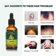 thumbnail image 4 of Aceite de jengibre para el crecimiento del cabello para mujeres y hombres, sérum de origen vegetal para cabello fino, 30 ml, 4 of 5