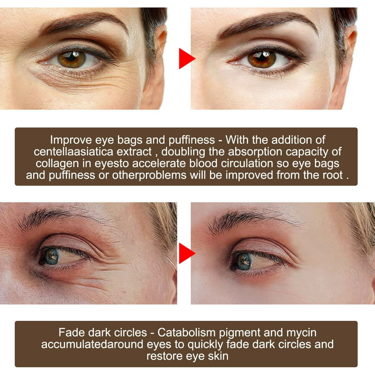 Brightening Under Eye Cream Remove Dark Circles Eye Bags Wrinkles Puffy Eye  30ML 