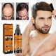thumbnail image 4 of 100ml 5% Minoxidil Spray para hombres Spray para el crecimiento del cabello para la caída y el crecimiento del cabello, 4 of 9