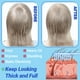 thumbnail image 3 of Dispositivo facial TUMAKOU Varita facial de alta frecuencia azul, 3 of 3