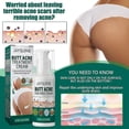 thumbnail image 2 of Crema hidratante para el cuidado de la cadera Jaysuing que atenúa las marcas de viruela, refresca y rejuvenece la piel, crema hidratante suave reparadora antiacné | | 100 ml |, 2 of 5