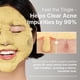 thumbnail image 5 of Mascarilla Burbuja Profunda P.CALM Turmeric & Agua Carbonatada 90g, 5 of 8