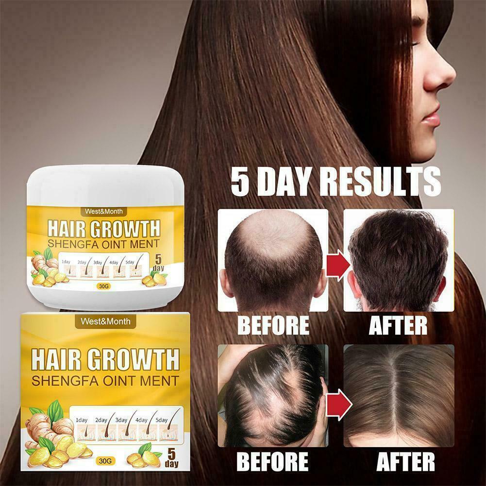 Ginger Oil Hair Growth Cream Repair Natural Ointment Treatments Loss