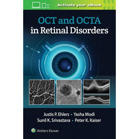 Oct and Octa in Retinal Disorders, (Paperback)