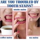 thumbnail image 1 of SP7 Toothpaste Ultra Whitening Toothpaste, Fluoride-Free Toothpaste Promotes Healthy Teeth and Gums Prevents Tartar Fresh Breath, Remove Yellow Stains, 1 of 2