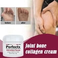 thumbnail image 3 of PERFECTX Joint Bone Colágeno Crema Para Alivio Del Dolor De Huesos Articulares Deformación Corrección Para Aliviar El Las Articulaciones El Cuidado De La Piel 30g, 3 of 4