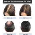 thumbnail image 5 of Ginger Plant Extract Anti-hair Loss Hair Shampoo, 2024 New Ginger Plant Extract Anti-hair Loss Hair Shampoo, Ginger Shampoo For Hair Growth_c*, 5 of 5