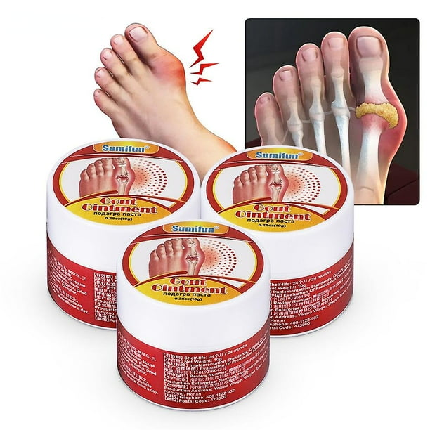 10g Gout Cream Toe Knee Joint Pain Cream Walmart.ca