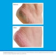 thumbnail image 3 of Crema para Pies O'Keeffe's Healthy Feet 91g Paquete de 6, 3 of 4