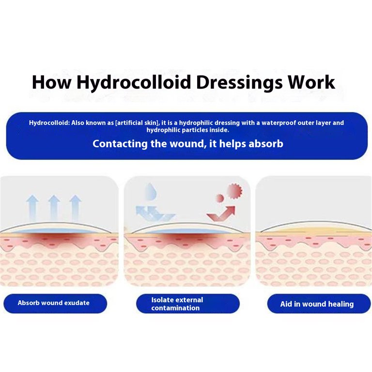 chinese dress ladies Hydrocolloid Healing: That White Gel Bubble - Blister Prevention