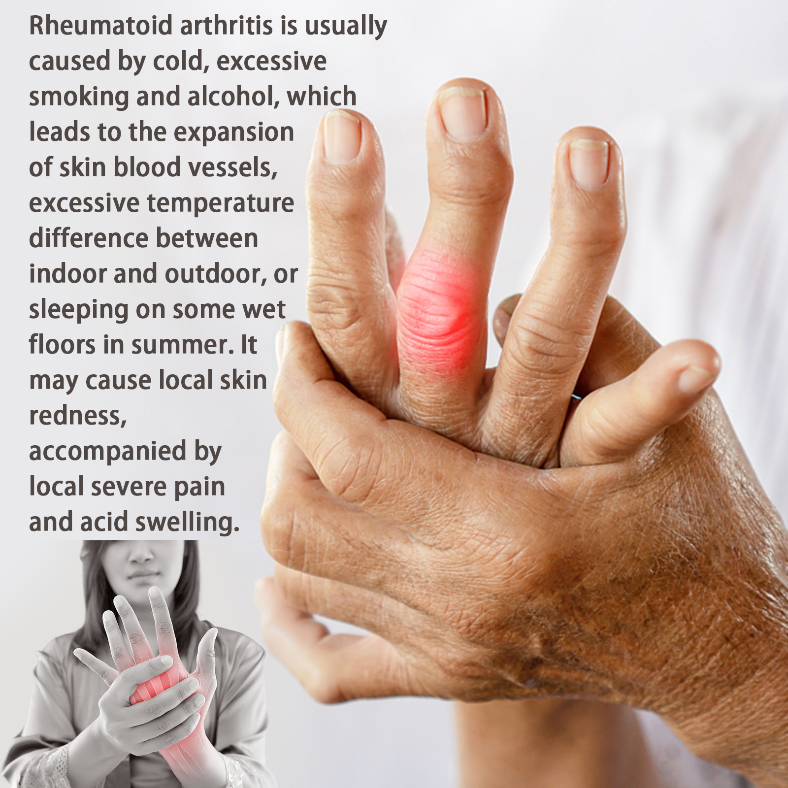Buy Traditional Chinese medicine can treat rheumatic joint pain, muscle