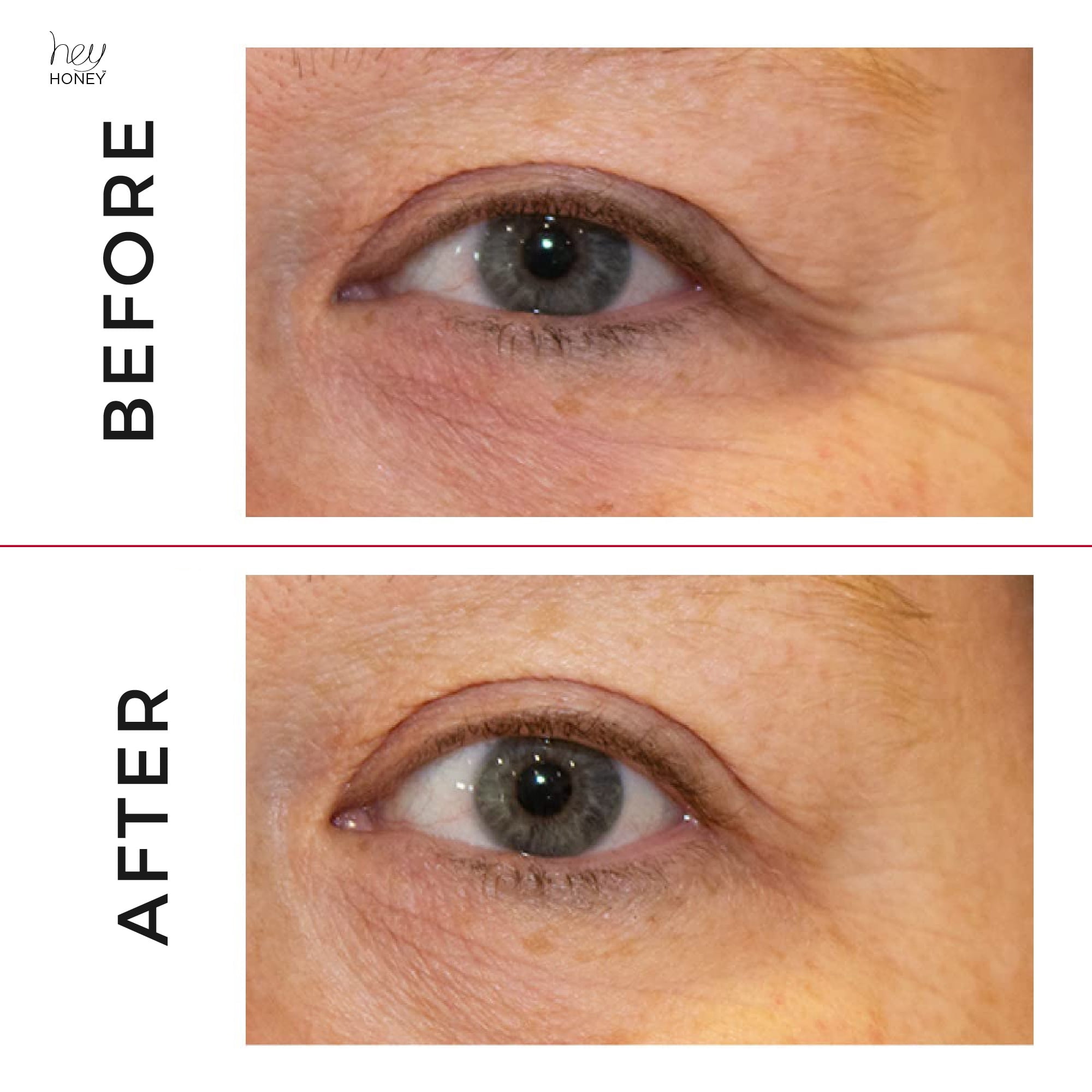 Hey Honey Open Your Eyes Lifting Eye Serum | Under Eye Cream for Dark Circles & Puffiness, 0.5 oz | 15 ml